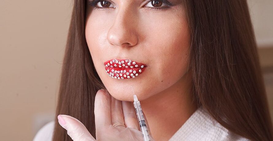 הגדלת שפתיים אסתטית ותיקון באמצעות חומרי מילוי
